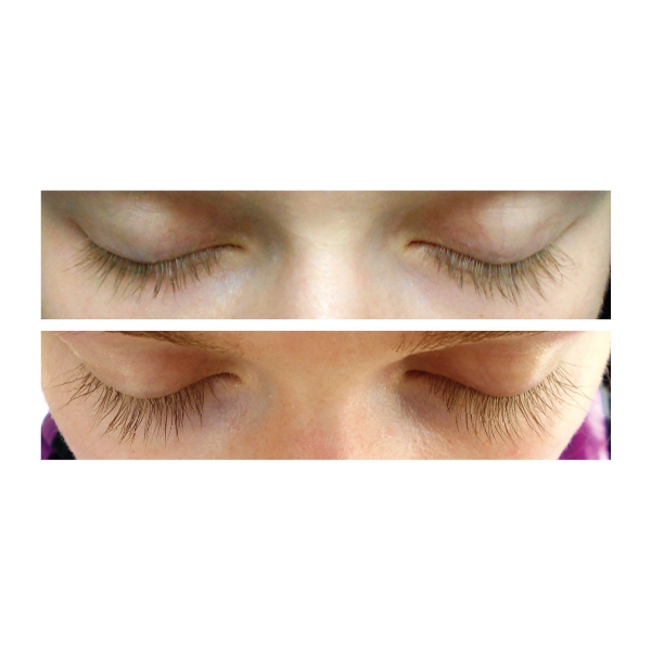 Xlash Eyelash Serum (Bild 2 von 2)